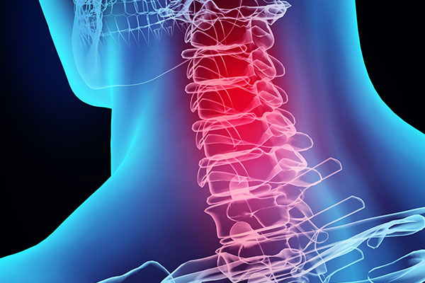 Neck pain can be far more than a pain in the neck. Healthy Walk Physical Therapy and Rehabilitation Iselin, NJ
